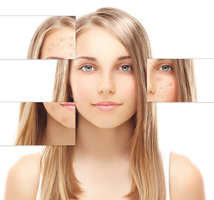 Ingredient-Spotlight-Kojic-Acid